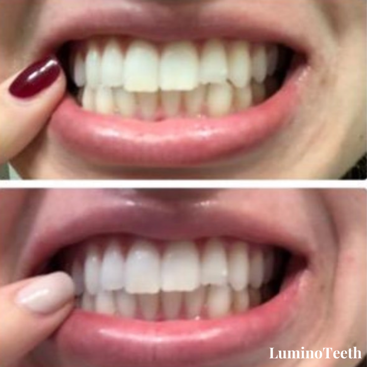 It Is Going Viral and The Before and Afters Say It All