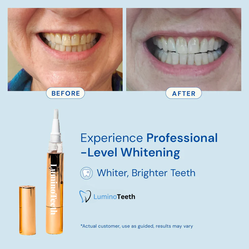 LuminoTeeth™ Whitening Serum